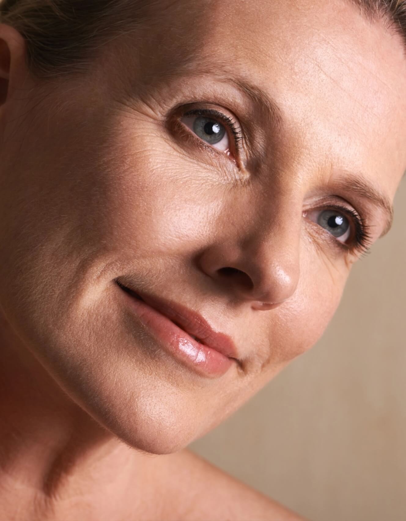 Facelift