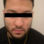 Rhinoplasty Male Before & After Patient #3904