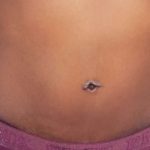 Tummy Tuck Before & After Patient #3066