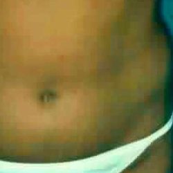 Liposuction Before & After Patient #2817