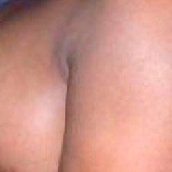 Breast Reduction Before & After Patient #2303