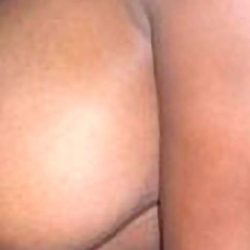 Breast Reduction Before & After Patient #2303