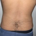 Daddy Makeover Before & After Patient #2506