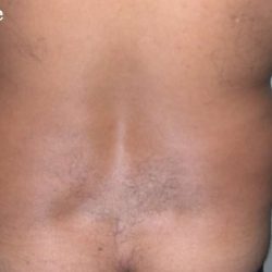 Daddy Makeover Before & After Patient #2506