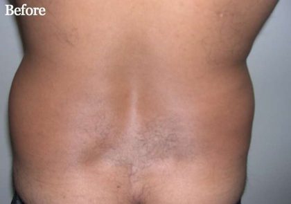 Daddy Makeover Before & After Patient #2506