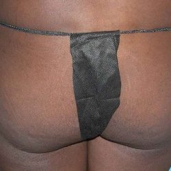 Buttock Augmentation Before & After Patient #2402