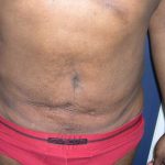 Daddy Makeover Before & After Patient #2527
