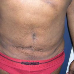 Daddy Makeover Before & After Patient #2527