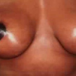 Breast Lift Before & After Patient #2300