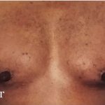 Daddy Makeover Before & After Patient #2532