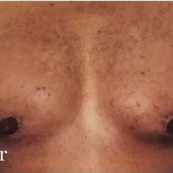 Daddy Makeover Before & After Patient #2532