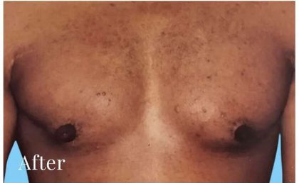 Daddy Makeover Before & After Patient #2532