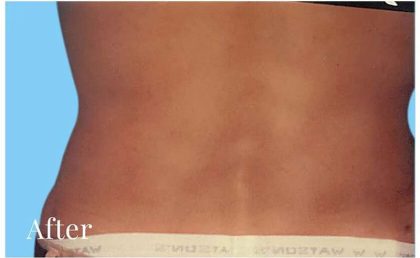 Daddy Makeover Before & After Patient #2532