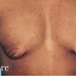 Daddy Makeover Before & After Patient #2532