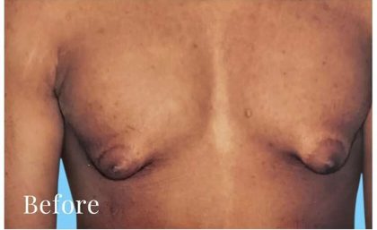 Daddy Makeover Before & After Patient #2532