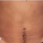 Daddy Makeover Before & After Patient #2521