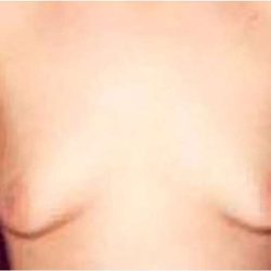 Daddy Makeover Before & After Patient #2521