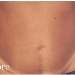 Daddy Makeover Before & After Patient #2521