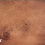 Daddy Makeover Before & After Patient #2511