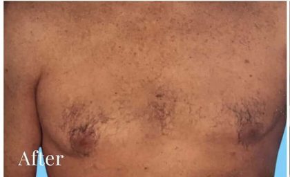 Daddy Makeover Before & After Patient #2511