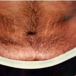 Daddy Makeover Before & After Patient #2511
