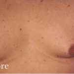 Daddy Makeover Before & After Patient #2511