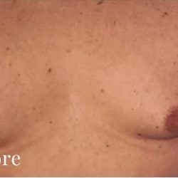 Daddy Makeover Before & After Patient #2511