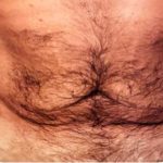 Daddy Makeover Before & After Patient #2511