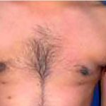 Daddy Makeover Before & After Patient #2516