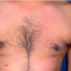 Daddy Makeover Before & After Patient #2516