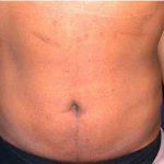 Daddy Makeover Before & After Patient #2516