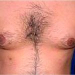 Daddy Makeover Before & After Patient #2516