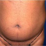 Daddy Makeover Before & After Patient #2516