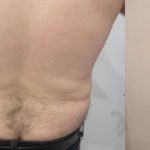 Daddy Makeover Before & After Patient #2503