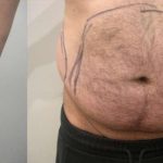 Daddy Makeover Before & After Patient #2503